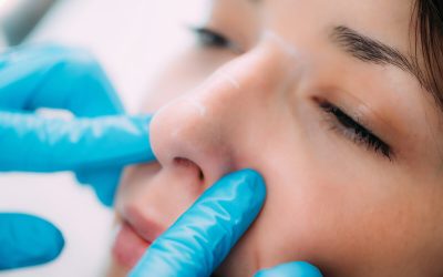 rinoplastia-para-quien